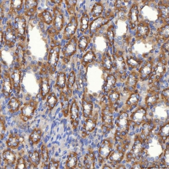 IHC staining of FFPE rat kidney tissue with SLC25A10 antibody. HIER: boil tissue sections in pH8 EDTA for 20 min and allow to cool before testing.