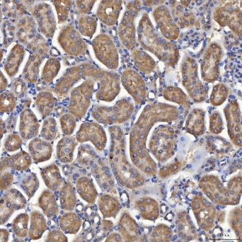 IHC staining of FFPE mouse kidney tissue with SLC25A10 antibody. HIER: boil tissue sections in pH8 EDTA for 20 min and allow to cool before testing.