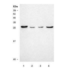 Western blot testing of 1) human HepG2, 2) human 293T, 3) rat liver and 4) rat kidney tissue lysate with SLC25A10 antibody. Predicted molecular weight ~31 kDa.