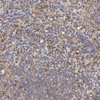 IHC staining of FFPE human spleen tissue with SLC25A10 antibody. HIER: boil tissue sections in pH8 EDTA for 20 min and allow to cool before testing.