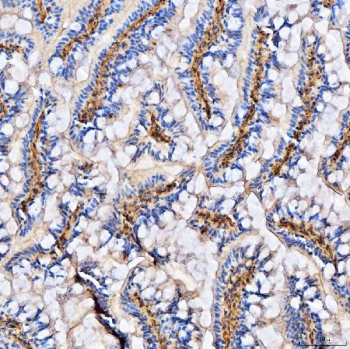 IHC staining of FFPE zebrafish tissue with Col6a2 antibody. HIER: boil tissue sections in pH8 EDTA for 20 min and allow to cool before testing.