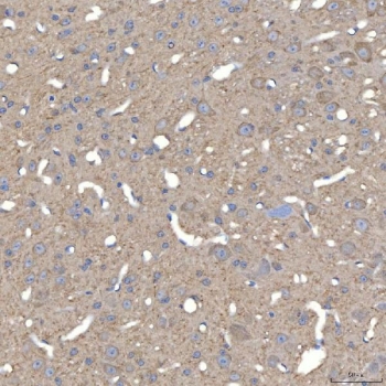 IHC staining of FFPE mouse brain tissue with SLC25A23 antibody. HIER: boil tissue sections in pH8 EDTA for 20 min and allow to cool before testing.