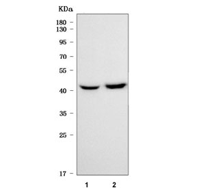 Western blot testing of 1) rat brain and 2) mouse brain tissue lysate with SLC25A23 antibody. Predicted molecular weight: 49-54 kDa (multiple isoforms).