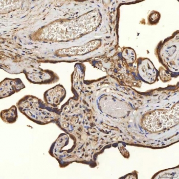 IHC staining of FFPE human placental tissue with SLC25A24 antibody. HIER: boil tissue sections in pH8 EDTA for 20 min and allow to cool before testing.