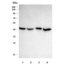 Western blot testing of human 1) 293T, 2) placenta, 3) A431 and 4) MCF7 cell lysate with SLC25A24 antibody. Predicted molecular weight: 51-53 kDa (two isoforms).