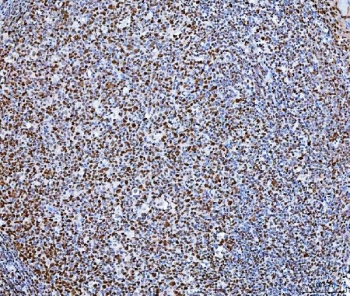 IHC staining of FFPE human tonsil tissue with Transcription factor SP1 antibody. HIER: boil tissue sections in pH8 EDTA for 20 min and allow to cool before testing.