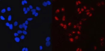 Immunofluorescent staining of FFPE human HeLa cells with Transcription factor SP1 antibody (red) and DAPI nuclear stain (blue). HIER: steam section in pH6 citrate buffer for 20 min.
