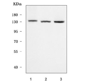 Western blot testing of human 1) MCF7, 2) HeLa and 3) K562 cell lysate with Fibroblast growth factor receptor 2 antibody. Predicted molecular weight: 80-120 kDa. The observed size may be larger due to glycosylation.