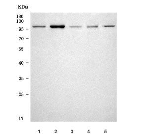 Western blot testing of 1) human placenta, 2) rat skeletal muscle, 3) rat ovary, 4) mouse skeletal muscle and 5) mouse C2C12 cell lysate with CAT2 antibody. Predicted molecular weight ~72 kDa but may be observed at higher molecular weights due to glycosylation.