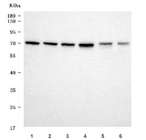 Western blot testing of 1) human Raji, 2) human A431, 3) human 293T, 4) human HepG2, 5) rat kidney and 6) rat liver tissue lysate with Citrin antibody. Predicted molecular weight ~74 kDa.