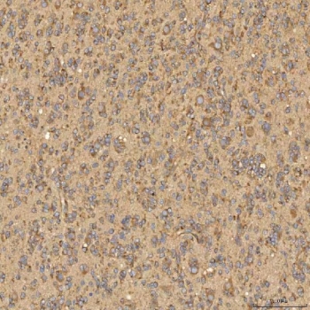 IHC staining of FFPE human brain tissue with Citrin antibody. HIER: boil tissue sections in pH8 EDTA for 20 min and allow to cool before testing.