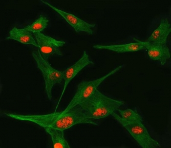 Immunofluorescent staining of FFPE human U-87 MG cells with TSEN34 antibody (red) and Beta Tubulin mAb (green). HIER: steam section in pH6 citrate buffer for 20 min.