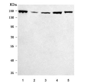 Western blot testing of 1) human HeLa, 2) human K562, 3) human U-87 MG, 4) rat PC-12 and 5) mouse lung tissue lysate with Rho kinase 2 antibody. Predicted molecular weight ~161 kDa.