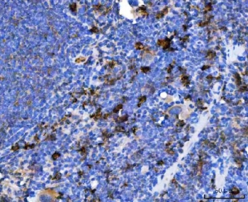 IHC staining of FFPE mouse spleen tissue with IHC staining of FFPE rat colon tissue with TXNDC5 antibody. HIER: boil tissue sections in pH8 EDTA for 20 min and allow to cool before testing.HIER: boil tissue sections in pH8 EDTA for 20 min and allow to cool before testing.