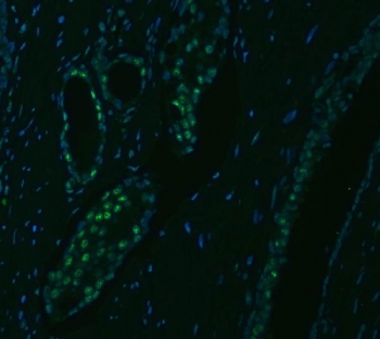 Immunofluorescent staining of FFPE human prostate cancer tissue with U2 snRNP A antibody (green) and DAPI nuclear stain (blue). HIER: steam section in pH8 EDTA buffer for 20 min.