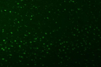 Immunofluorescent staining of FFPE mouse brain tissue with U2 snRNP A antibody (green) and DAPI nuclear stain (blue). HIER: steam section in pH8 EDTA buffer for 20 min.