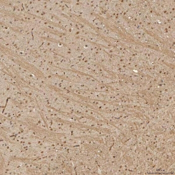 IHC staining of FFPE rat brain tissue with Sm-D3 antibody. HIER: boil tissue sections in pH8 EDTA for 20 min and allow to cool before testing.