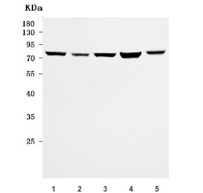 Western blot testing of 1) human U-87 MG, 2) human K562, 3) human Daudi, 4) human HEL1 and 5) mouse ovary tissue lysate with URI1 antibody. Predicted molecular weight ~60 kDa, can be observed at 70-80 kDa.