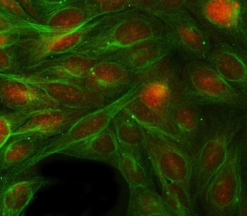 Immunofluorescent staining of FFPE human U-2 OS cells with Retinol Binding Protein 1 antibody (red) and Alpha Tubulin mAb (green). HIER: steam section in pH6 citrate buffer for 20 min.