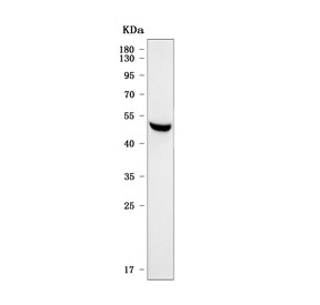 Western blot testing of human RT4 cell lysate with Sorting nexin 31 antibody. Predicted molecular weight ~51 kDa.