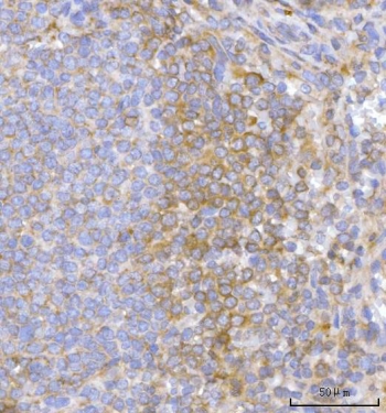 IHC staining of FFPE human spleen tissue with Hamartin antibody. HIER: boil tissue sections in pH8 EDTA for 20 min and allow to cool before testing.
