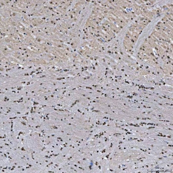 IHC staining of FFPE rat brain tissue with SNRNP27 antibody. HIER: boil tissue sections in pH8 EDTA for 20 min and allow to cool before testing.