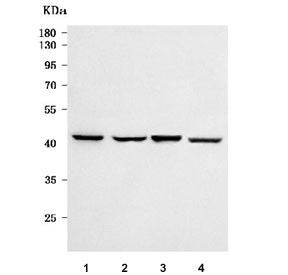 Western blot testing of human 1) 293T, 2) HeLa, 3) A375 and 4) MCF7 cell lysate with Scurfin antibody. Predicted molecular weight ~47 kDa.