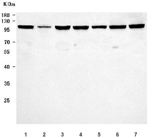 Western blot testing of human 1) HepG2, 2) HL60, 3) 293T, 4) Daudi, 5) HaCaT, 6) HeLa and 7) MOLT4 cell lysate with EZH1 antibody. Predicted molecular weight: 69-86 kDa (multiple isoforms).