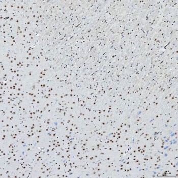 IHC staining of FFPE rat brain tissue with SNRNP200 antibody. HIER: boil tissue sections in pH8 EDTA for 20 min and allow to cool before testing.