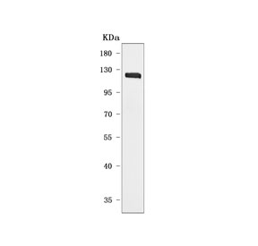 Western blot testing of human SH-SY5Y cell lysate with DBL antibody. Predicted molecular weight: 96-116 kDa (multiple isoforms).