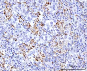 IHC staining of FFPE human testicular seminoma tissue with UBXN8 antibody. HIER: boil tissue sections in pH8 EDTA for 20 min and allow to cool before testing.