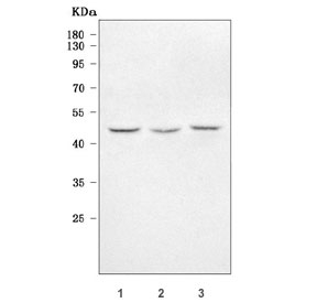 Western blot testing of human 1) MCF7, 2) SiHa and 3) U-87 MG cell lysate with TMEM59 antibody. Predicted molecular weight ~36 kDa but may be observed at higher molecular weights due to glycosylation.