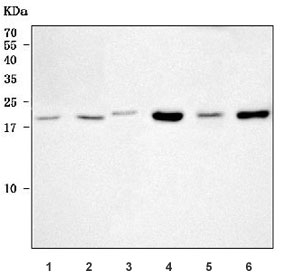 Western blot testing of 1) human MCF7, 2) human HepG2, 3) rat ovary, 4) rat brain, 5) mouse ovary and 6) mouse brain tissue lysate with Bcl-2-related ovarian killer protein antibody. Predicted molecular weight ~23 kDa.