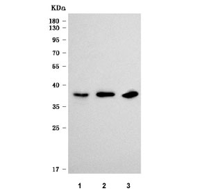Western blot testing of 1) human SiHa, 2) human Daudi and 3) mouse thymus tissue lysate with SLC35D1 antibody. Predicted molecular weight ~39 kDa.