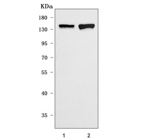 Western blot testing of 1) rat eye and 2) mouse eye tissue lysate with IRBP antibody. Predicted molecular weight ~135 kDa.