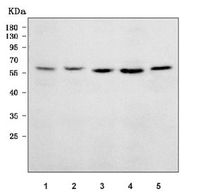 Western blot testing of 1) human Daudi, 2) human Jurkat, 3) human SH-SY5Y, 4) rat brain and 5) mouse brain tissue lysate with Syntrophin gamma 2 antibody. Predicted molecular weight ~60 kDa.