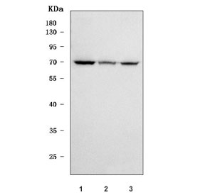 Western blot testing of human 1) HepG2, 2) MCF7 and 3) 293T cell lysate with SGSH antibody. Predicted molecular weight ~56 kDa but may be observed at higher molecular weights due to glycosylation.