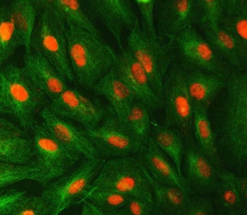 Immunofluorescent staining of FFPE human A549 cells with STX6 antibody (red) and Beta Tubulin mAb (green). HIER: steam section in pH6 citrate buffer for 20 min.