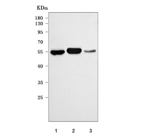 Western blot testing of 1) human MOLT4, 2) mouse thymus and 3) mouse spleen tissue lysate with RAG2 antibody. Predicted molecular weight ~59 kDa.