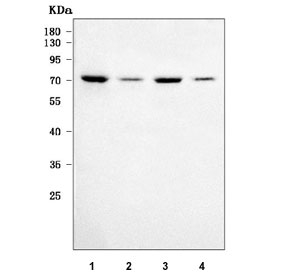 Western blot testing of human 1) SH-SY5Y, 2) U-2 OS, 3) HEL and 4) Daudi cell lysate with Regulator of G-protein signaling 9 antibody. Predicted molecular weight: 50-77 kDa (multiple isoforms).