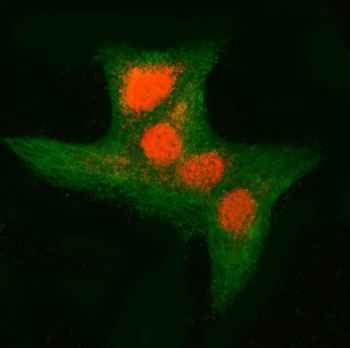 Immunofluorescent staining of FFPE human A549 cells with RNF34 antibody (red) and Beta Tubulin mAb (green). HIER: steam section in pH6 citrate buffer for 20 min.