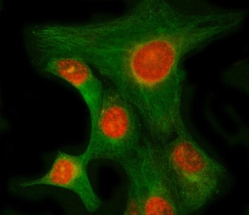 Immunofluorescent staining of FFPE human HeLa cells with RIMKLB antibody (red) and Beta Tubulin mAb (green). HIER: steam section in pH6 citrate buffer for 20 min.