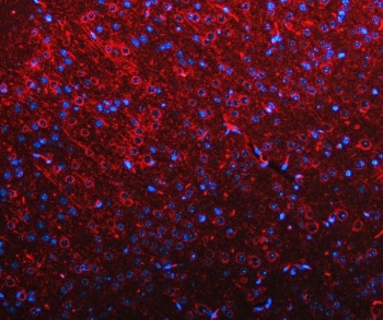 Immunofluorescent staining of FFPE mouse brain tissue with RIMS-binding protein 2 antibody (red) and DAPI nuclear stain (blue). HIER: steam section in pH8 EDTA buffer for 20 min.