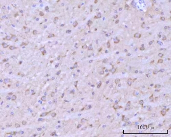 IHC staining of FFPE mouse brain tissue with RIMS-binding protein 2 antibody. HIER: boil tissue sections in pH8 EDTA for 20 min and allow to cool before testing.