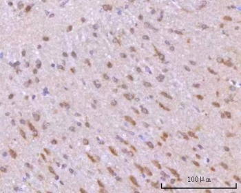 IHC staining of FFPE rat brain tissue with RIMS-binding protein 2 antibody. HIER: boil tissue sections in pH8 EDTA for 20 min and allow to cool before testing.