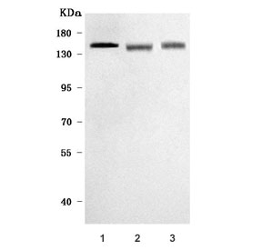 Western blot testing of 1) human SH-SY5Y, 2) rat brain and 3) mouse brain tissue lysate with RIMS-binding protein 2 antibody. Predicted molecular weight ~116 kDa.