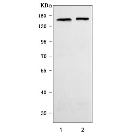 Western blot testing of 1) rat brain and 2) mouse brain tissue lysate with RPGRIP1L antibody. Predicted molecular weight ~151 kDa.