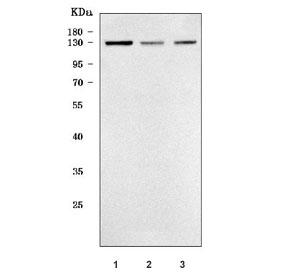 Western blot testing of human 1) MCF7, 2) T-47D and 3) SH-SY5Y cell lysate with TMEM132A antibody. Predicted molecular weight ~110 kDa but may be observed at a higher molecular weight due to glycosylation.