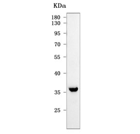 Western blot testing of human U-2 OS cell lysate with OLAH antibody. Predicted molecular weight ~30 kDa and ~36 kDa (two isoforms).