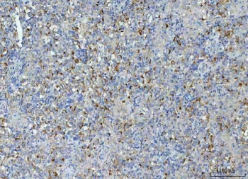 IHC staining of FFPE human testicular seminoma tissue with TMEM87A antibody. HIER: boil tissue sections in pH8 EDTA for 20 min and allow to cool before testing.